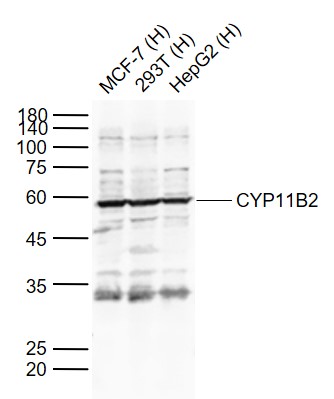 Lane 1: Human MCF-7 cell lysates; Lane 2: Human 293T cell lysates; Lane 3: Human HepG2 cell lysates probed with CYP11B2 Polyclonal Antibody, Unconjugated (bs-23822R) at 1:1000 dilution and 4°C overnight incubation. Followed by conjugated secondary antibody incubation at 1:20000 for 60 min at 37˚C.