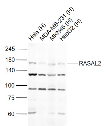 Lane 1: Human Hela cell lysates; Lane 2: Human MDA-MB-231 cell lysates; Lane 3: Human MKN45 cell lysates; Lane 4: Human HepG2 celll lysates probed with RASAL2 Polyclonal Antibody, Unconjugated (bs-21160R) at 1:1000 dilution and 4°C overnight incubation. Followed by conjugated secondary antibody incubation at 1:20000 for 60 min at 37˚C.