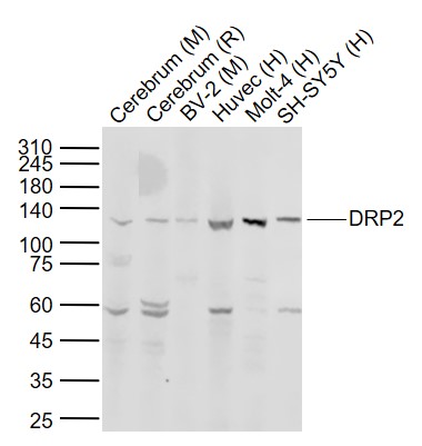 Lane 1: Mouse Cerebrum tissue lysates; Lane 2: Rat Cerebrum tissue lysates; Lane 3: Mouse BV-2 cell lysates; Lane 4: Human Huvec cell lysates ; Lane 5: Human Molt-4 cell lysates ; Lane 6: Human SH-SY5Y cell lysates probed with DRP2 Polyclonal Antibody, Unconjugated (bs-14428R) at 1:1000 dilution and 4°C overnight incubation. Followed by conjugated secondary antibody incubation at 1:20000 for 60 min at 37˚C.