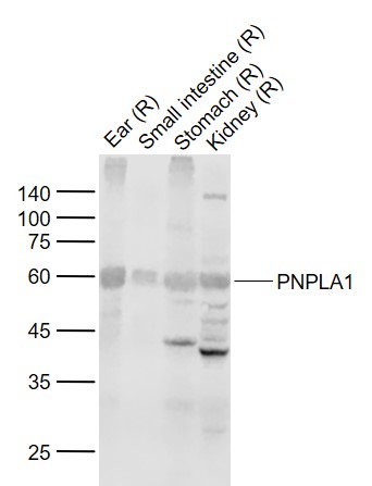 Lane 1: Rat Ear tissue lysates; Lane 2: Rat Smal intestine tissue lysates; Lane 3: Rat Stomach tissue lysates; Lane 4: Rat Kidney tissue lysates probed with PNPLA1 Polyclonal Antibody, Unconjugated (bs-24622R) at 1:1000 dilution and 4°C overnight incubation. Followed by conjugated secondary antibody incubation at 1:20000 for 60 min at 37˚C.