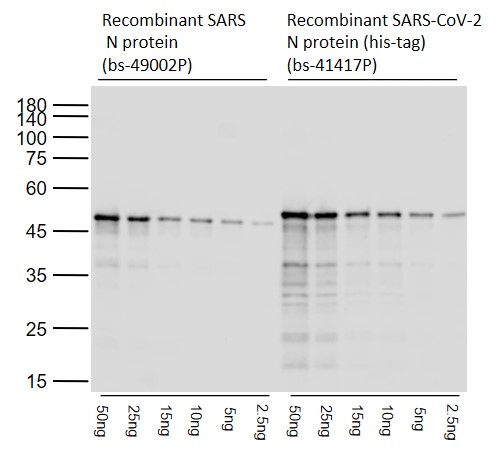 Lane 1~6: Recombinant SARS-CoV Nucleocapsid protein; Lane 7~12: Recombinant SARS-CoV-2 Nucleocapsid Protein probed with SARS-CoV-2 N Polyclonal Antibody, Unconjugated (bs-41417R) at 1:2000 dilution and 4°C overnight incubation. Followed by conjugated secondary antibody incubation at 1:20000 for 60 min at 37˚C.