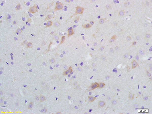 Formalin-fixed and paraffin embedded rat brain tissue labeled with Anti-SCD1 Polyclonal Antibody, Unconjugated (bs-3787R) at 1:200 followed by conjugation to the secondary antibody and DAB staining