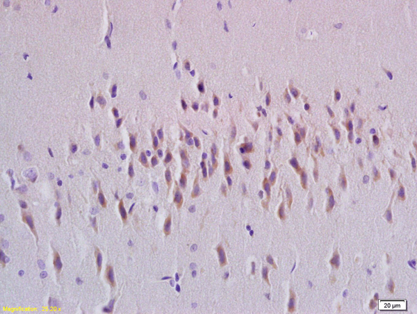 Formalin-fixed and paraffin embedded rat brain tissue labeled with Anti-Rab24 Polyclonal Antibody, Unconjugated (bs-3868R) at 1:200 followed by conjugation to the secondary antibody and DAB staining