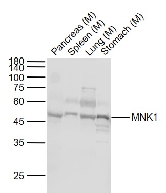 Lane 1: Mouse Pancreas tissue lysates; Lane 2: Mouse Spleen tissue lysates; Lane 3: Mouse Lung tissue lysates; Lane 4: Mouse Stomach tissue lysates probed with MNK1 Polyclonal Antibody, Unconjugated (bs-17694R) at 1:1000 dilution and 4˚C overnight incubation. Followed by conjugated secondary antibody incubation at 1:20000 for 60 min at 37˚C.