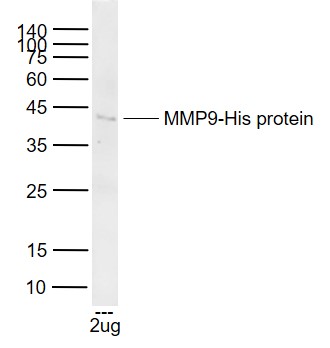 Lane 1: Recombinant MMP9-His protein probed with MMP9 Polyclonal Antibody, Unconjugated (bs-20619R) at 1:1000 dilution and 4˚C overnight incubation. Followed by conjugated secondary antibody incubation at 1:20000 for 60 min at 37˚C.