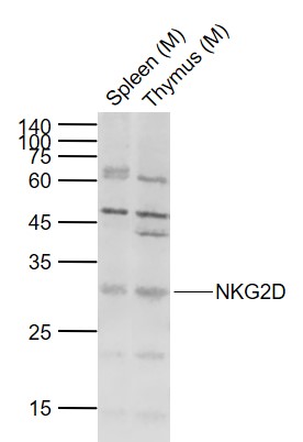 Lane 1: Mouse Spleen tissue lysates; Lane 2: Mouse Thymus tissue lysates probed with NKG2D Polyclonal Antibody, Unconjugated (bs-21454R) at 1:300 dilution and 4˚C overnight incubation. Followed by conjugated secondary antibody incubation at 1:20000 for 60 min at 37˚C.