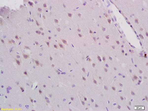 Formalin-fixed and paraffin embedded rat brain tissue labeled with Anti-MEK5\/MAP2K5  Polyclonal Antibody, Unconjugated (bs-4124R) at 1:200 followed by conjugation to the secondary antibody and DAB staining