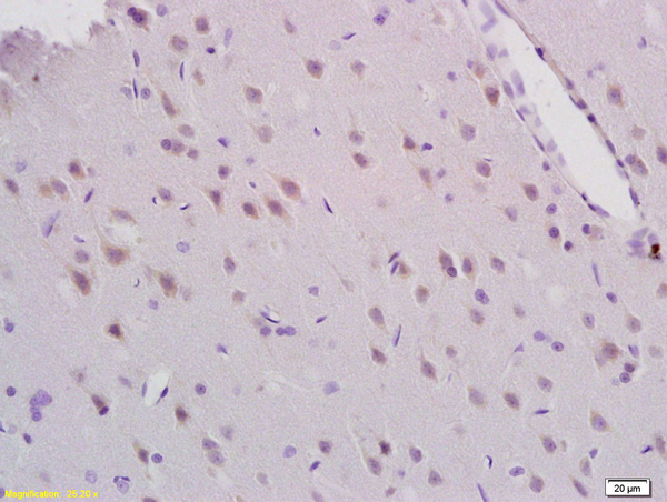 Formalin-fixed and paraffin embedded rat brain tissue labeled with Anti-MEK5/MAP2K5 Polyclonal Antibody, Unconjugated (bs-4124R) at 1:200 followed by conjugation to the secondary antibody and DAB staining