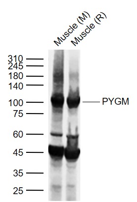 Lane 1: Mouse Muscle tissue lysates; Lane 2: Rat Muscle tissue lysates probed with PYGM Polyclonal Antibody, Unconjugated (bs-5012R) at 1:1000 dilution and 4°C overnight incubation. Followed by conjugated secondary antibody incubation at 1:20000 for 60 min at 37˚C.