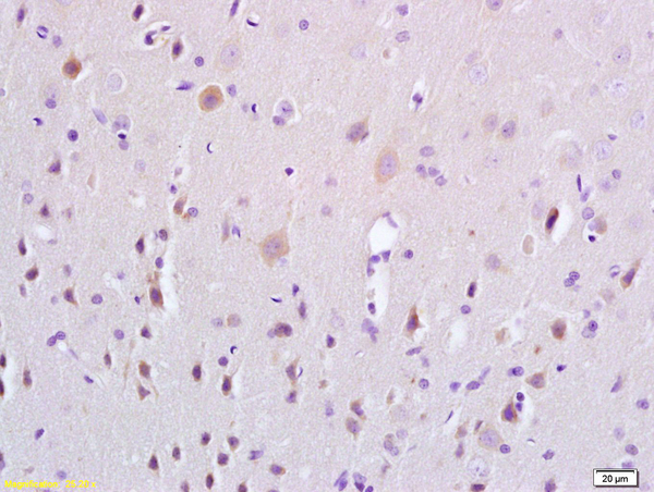 Formalin-fixed and paraffin embedded rat brain tissue labeled with Anti-ERK4 Polyclonal Antibody, Unconjugated (bs-4131R) at 1:200 followed by conjugation to the secondary antibody and DAB staining