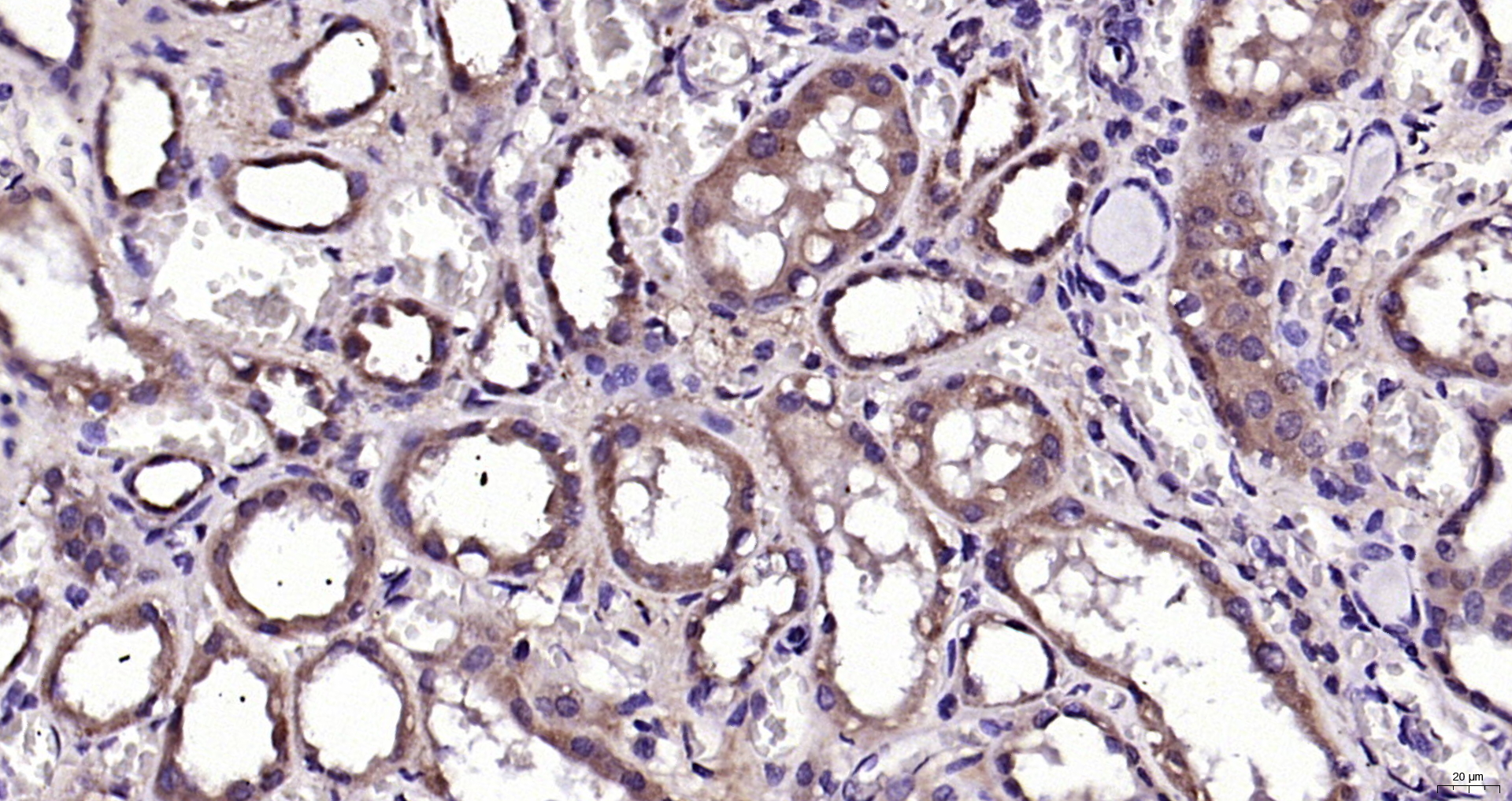 Paraformaldehyde-fixed, paraffin embedded Human kidney; Antigen retrieval by boiling in sodium citrate buffer (pH6.0) for 15min; Block endogenous peroxidase by 3% hydrogen peroxide for 20 minutes; Blocking buffer (normal goat serum) at 37°C for 30min; Antibody incubation with ALDH3A2 Polyclonal Antibody, Unconjugated (bs-11797R) at 1:200 overnight at 4°C, DAB staining.