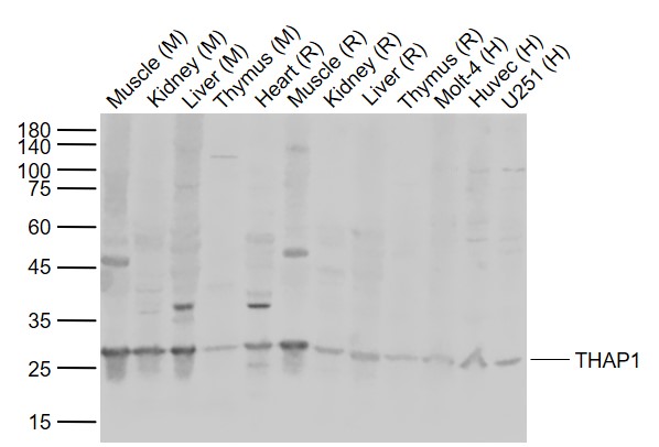 Lane 1: Mouse Muscle tissue lysates; Lane 2: Mouse Kidney tissue lysates; Lane 3: Mouse Liver tissue lysates; Lane 4: Mouse Thymus tissue lysates ; Lane 5: Rat Heart tissue lysates ; Lane 6: Rat Muscle tissue lysates ; Lane 7: Rat Kidney tissue lysates ; Lane 8: Rat Liver tissue lysates ; Lane 9: Rat Thymus tissue lysates ; Lane 10: Human Molt-4 cell lysates ; Lane 11: Human Huvec cell lysates ; Lane 12: Human U251 cell lysates probed with THAP1 Polyclonal Antibody, Unconjugated (bs-7103R) at 1:1000 dilution and 4°C overnight incubation. Followed by conjugated secondary antibody incubation at 1:20000 for 60 min at 37˚C.