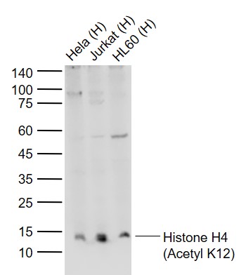 Lane 1: Human Hela cell lysates; Lane 2: Human Jurkat cell lysates; Lane 3: Human HL60 cell lysates probed with Histone H4 (Acetyl K12) Polyclonal Antibody, Unconjugated (bs-3746R) at 1:1000 dilution and 4\u00b0C overnight incubation. Followed by conjugated secondary antibody incubation at 1:20000 for 60 min at 37˚C.