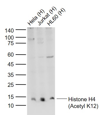 Lane 1: Human Hela cell lysates; Lane 2: Human Jurkat cell lysates; Lane 3: Human HL60 cell lysates probed with Histone H4 (Acetyl K12) Polyclonal Antibody, Unconjugated (bs-3746R) at 1:1000 dilution and 4°C overnight incubation. Followed by conjugated secondary antibody incubation at 1:20000 for 60 min at 37˚C.
