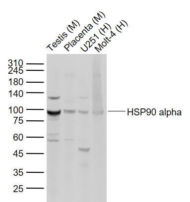 Lane 1: Mouse Testis tissue lysates; Lane 2: Mouse Placenta tissue lysates; Lane 3: Human U251 cell lysates; Lane 4: Human Molt-4 cell lysates probed with HSP90 alpha Polyclonal Antibody, Unconjugated (bs-10100R) at 1:1000 dilution and 4°C overnight incubation. Followed by conjugated secondary antibody incubation at 1:20000 for 60 min at 37˚C.