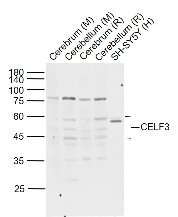 Lane 1: Mouse Cerebrum tissue lysates; Lane 2: Mouse Cerebellum tissue lysates; Lane 3: Rat Cerebrum tissue lysates; Lane 4: Rat Cerebellum tissue lysates ; Lane 5: Human SH-SY5Y cell lysates probed with CELF3 Polyclonal Antibody, Unconjugated (bs-13830R) at 1:1000 dilution and 4°C overnight incubation. Followed by conjugated secondary antibody incubation at 1:20000 for 60 min at 37˚C.