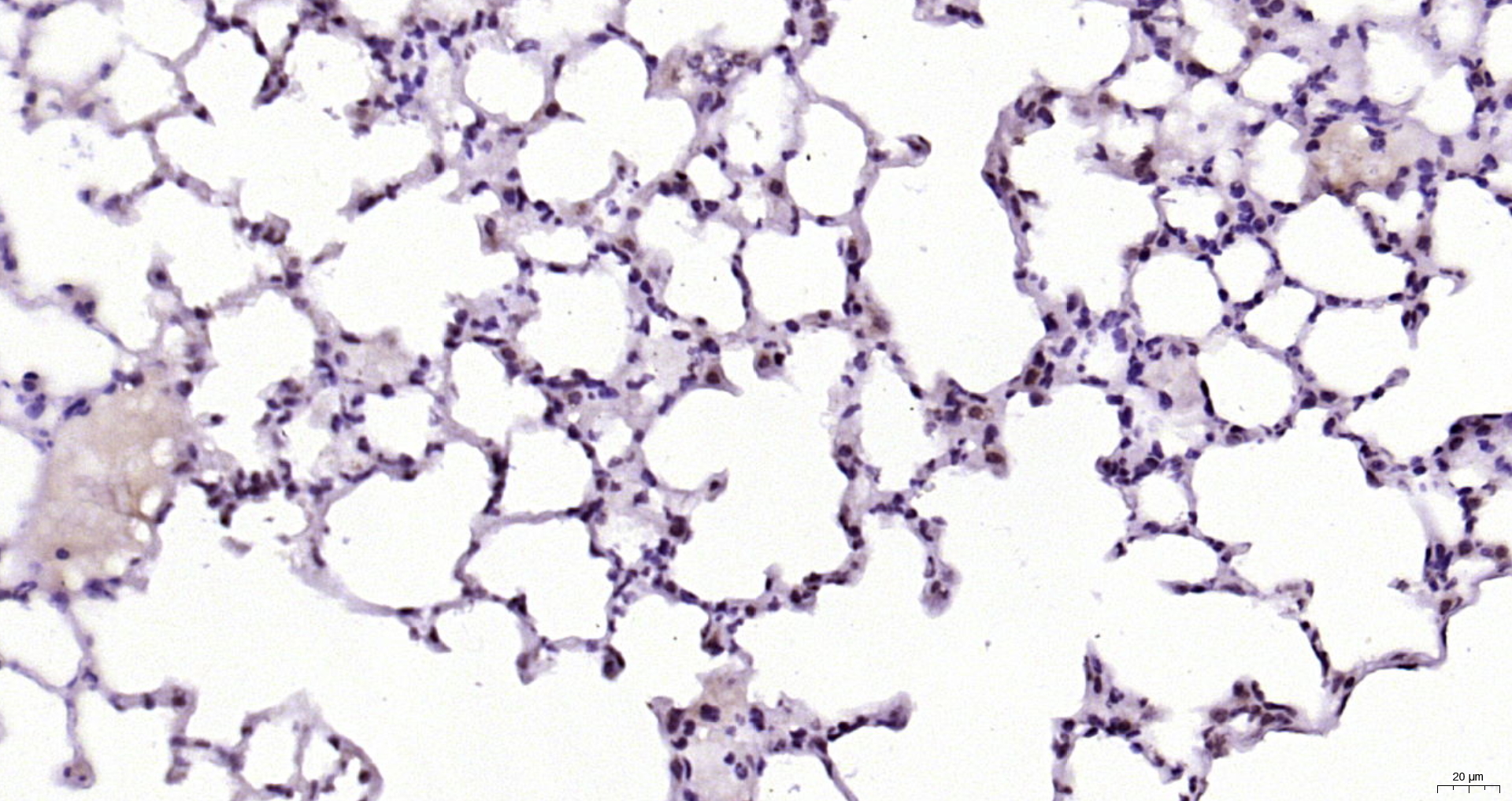 Paraformaldehyde-fixed, paraffin embedded Rat lung; Antigen retrieval by boiling in sodium citrate buffer (pH6.0) for 15min; Block endogenous peroxidase by 3% hydrogen peroxide for 20 minutes; Blocking buffer (normal goat serum) at 37°C for 30min; Antibody incubation with NOL11 Polyclonal Antibody, Unconjugated (bs-19308R) at 1:200 overnight at 4°C, DAB staining.