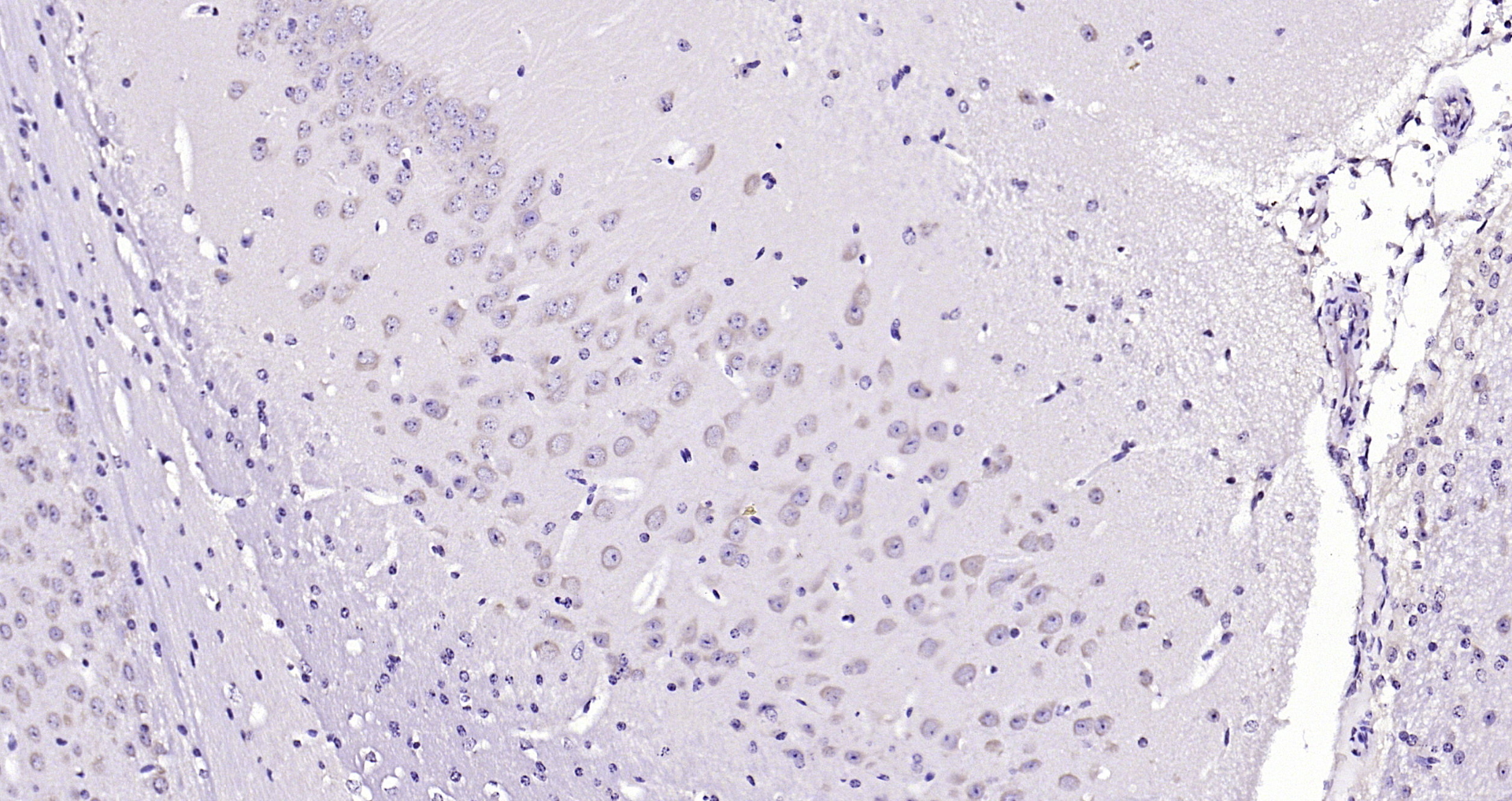 Paraformaldehyde-fixed, paraffin embedded Mouse brain; Antigen retrieval by boiling in sodium citrate buffer (pH6.0) for 15min; Block endogenous peroxidase by 3% hydrogen peroxide for 20 minutes; Blocking buffer (normal goat serum) at 37°C for 30min; Antibody incubation with CRHR1 Polyclonal Antibody, Unconjugated (bs-10248R) at 1:200 overnight at 4°C, DAB staining. Paraformaldehyde-fixed, paraffin embedded Mouse brain; Antigen retrieval by boiling in sodium citrate buffer (pH6.0) for 15min; Block endogenous peroxidase by 3% hydrogen peroxide for 20 minutes; Blocking buffer (normal goat serum) at 37°C for 30min; Antibody incubation with CRHR1 Polyclonal Antibody, Unconjugated (bs-10248R) at 1:200 overnight at 4°C, DAB staining.