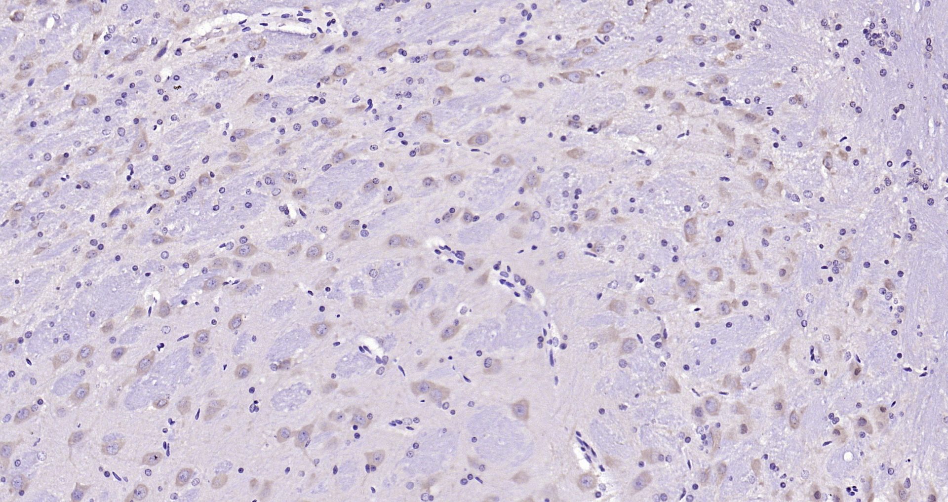 Paraformaldehyde-fixed, paraffin embedded Rat brain; Antigen retrieval by boiling in sodium citrate buffer (pH6.0) for 15min; Block endogenous peroxidase by 3% hydrogen peroxide for 20 minutes; Blocking buffer (normal goat serum) at 37°C for 30min; Antibody incubation with CRHR1 Polyclonal Antibody, Unconjugated (bs-10248R) at 1:200 overnight at 4°C, DAB staining. Paraformaldehyde-fixed, paraffin embedded Rat brain; Antigen retrieval by boiling in sodium citrate buffer (pH6.0) for 15min; Block endogenous peroxidase by 3% hydrogen peroxide for 20 minutes; Blocking buffer (normal goat serum) at 37°C for 30min; Antibody incubation with CRHR1 Polyclonal Antibody, Unconjugated (bs-10248R) at 1:200 overnight at 4°C, DAB staining.