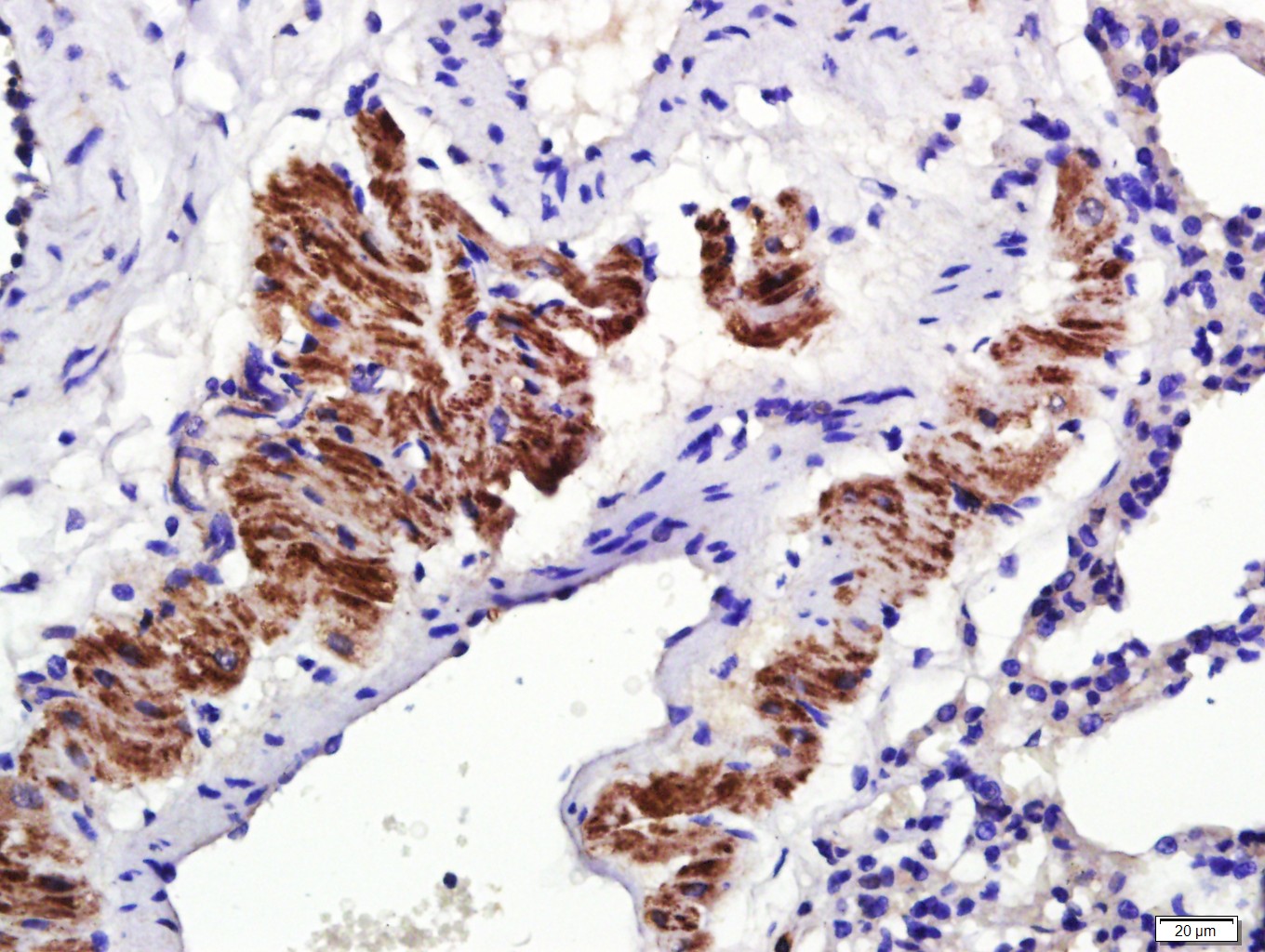 Paraformaldehyde-fixed, paraffin embedded Rat lung; Antigen retrieval by boiling in sodium citrate buffer (pH6.0) for 15min; Block endogenous peroxidase by 3% hydrogen peroxide for 20 minutes; Blocking buffer (normal goat serum) at 37°C for 30min; Antibody incubation with Osteopontin Polyclonal Antibody, Unconjugated (bs-0026R) at 1:400 overnight at 4°C, DAB staining.