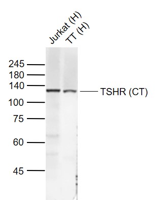 Lane 1: Human Jurkat cell lysates; Lane 2: Human TT cell lysates probed with TSHR (CT) Polyclonal Antibody, Unconjugated (bs-0206R) at 1:2000 dilution and 4°C overnight incubation. Followed by conjugated secondary antibody incubation at 1:20000 for 60 min at 37˚C.