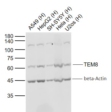 Lane 1: Human A549 cell lysates; Lane 2: Human HepG2 cell lysates; Lane 3: Human SH-SY5Y cell lysates; Lane 4: Human Hela cell lysates ; Lane 5: Human U2os cell lysates probed with TEM8 Polyclonal Antibody, Unconjugated (bs-15583R) at 1:1000 dilution and 4°C overnight incubation. Followed by conjugated secondary antibody incubation at 1:20000 for 60 min at 37˚C.