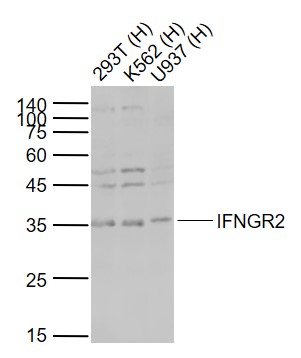 Lane 1: Human 293T cell lysates; Lane 2: Human K562 cell lysates; Lane 3: Human U937 cell lysates probed with IFNGR2 Polyclonal Antibody, Unconjugated (bs-2710R) at 1:1000 dilution and 4°C overnight incubation. Followed by conjugated secondary antibody incubation at 1:20000 for 60 min at 37˚C.