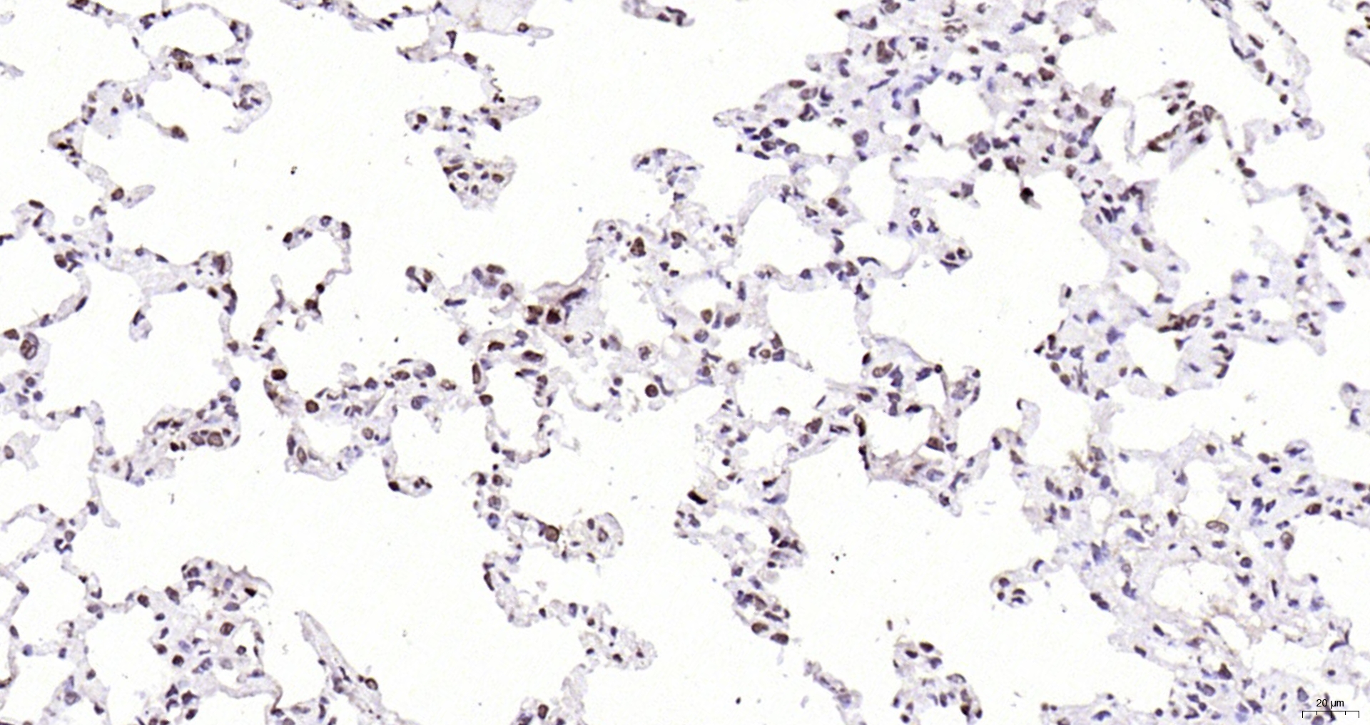 Paraformaldehyde-fixed, paraffin embedded Rat lung; Antigen retrieval by boiling in sodium citrate buffer (pH6.0) for 15min; Block endogenous peroxidase by 3% hydrogen peroxide for 20 minutes; Blocking buffer (normal goat serum) at 37°C for 30min; Antibody incubation with CDKN1A Polyclonal Antibody, Unconjugated (bs-0741R) at 1:200 overnight at 4°C, DAB staining.