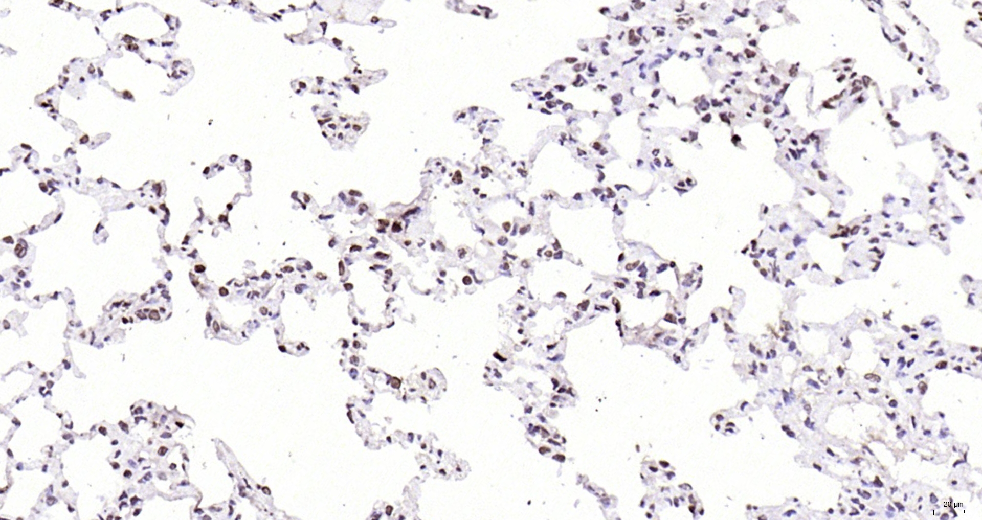 Paraformaldehyde-fixed, paraffin embedded Rat lung; Antigen retrieval by boiling in sodium citrate buffer (pH6.0) for 15min; Block endogenous peroxidase by 3% hydrogen peroxide for 20 minutes; Blocking buffer (normal goat serum) at 37°C for 30min; Antibody incubation with CDKN1A Polyclonal Antibody, Unconjugated (bs-0741R) at 1:200 overnight at 4°C, DAB staining.