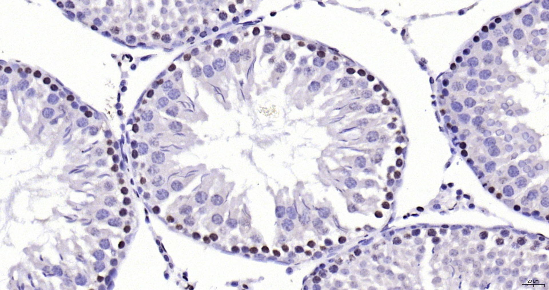 Paraformaldehyde-fixed, paraffin embedded Rat testis; Antigen retrieval by boiling in sodium citrate buffer (pH6.0) for 15min; Block endogenous peroxidase by 3% hydrogen peroxide for 20 minutes; Blocking buffer (normal goat serum) at 37°C for 30min; Antibody incubation with CDKN1A Polyclonal Antibody, Unconjugated (bs-0741R) at 1:200 overnight at 4°C, DAB staining.