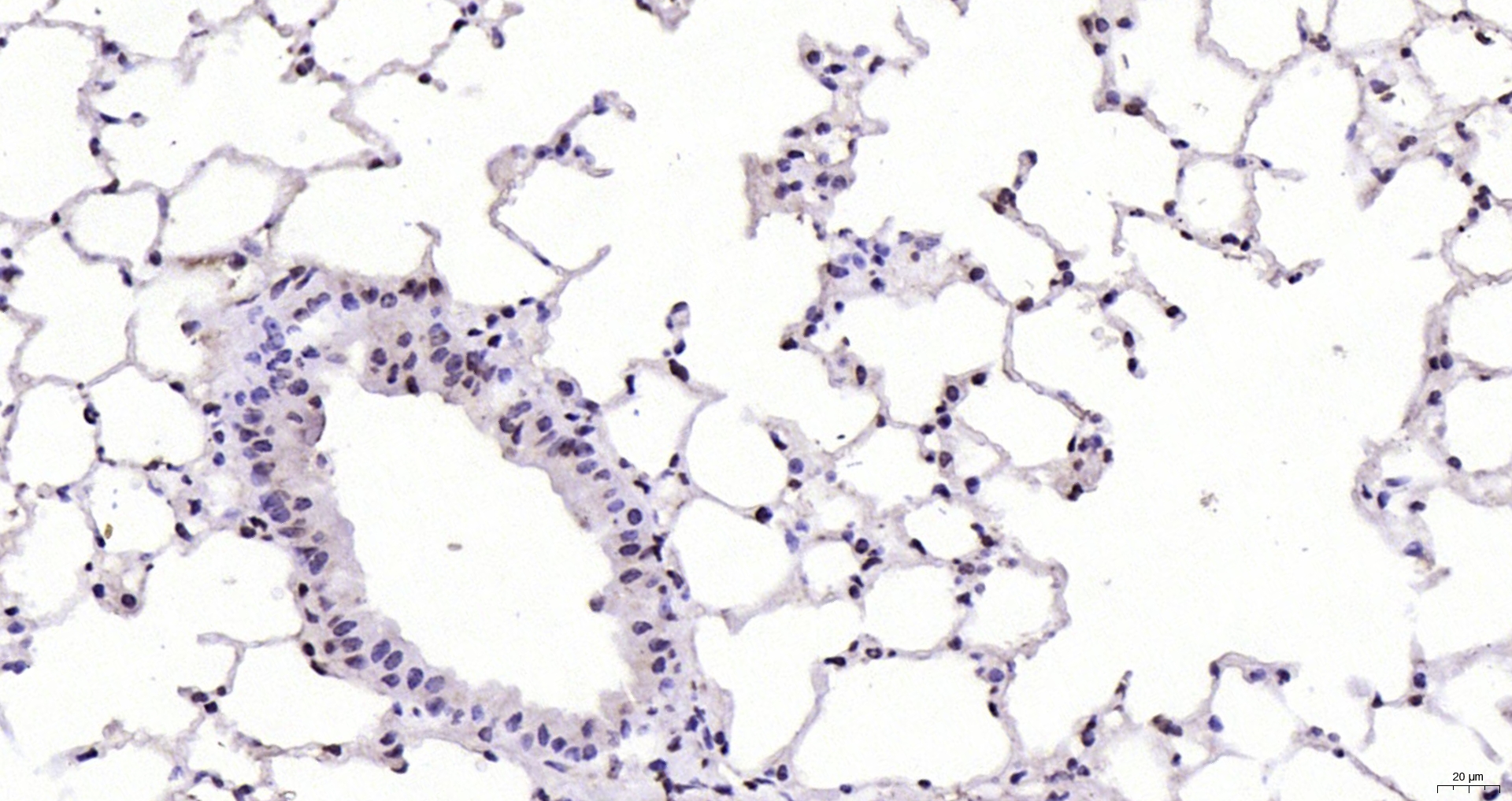 Paraformaldehyde-fixed, paraffin embedded Mouse lung; Antigen retrieval by boiling in sodium citrate buffer (pH6.0) for 15min; Block endogenous peroxidase by 3% hydrogen peroxide for 20 minutes; Blocking buffer (normal goat serum) at 37°C for 30min; Antibody incubation with CDKN1A Polyclonal Antibody, Unconjugated (bs-0741R) at 1:200 overnight at 4°C, DAB staining.