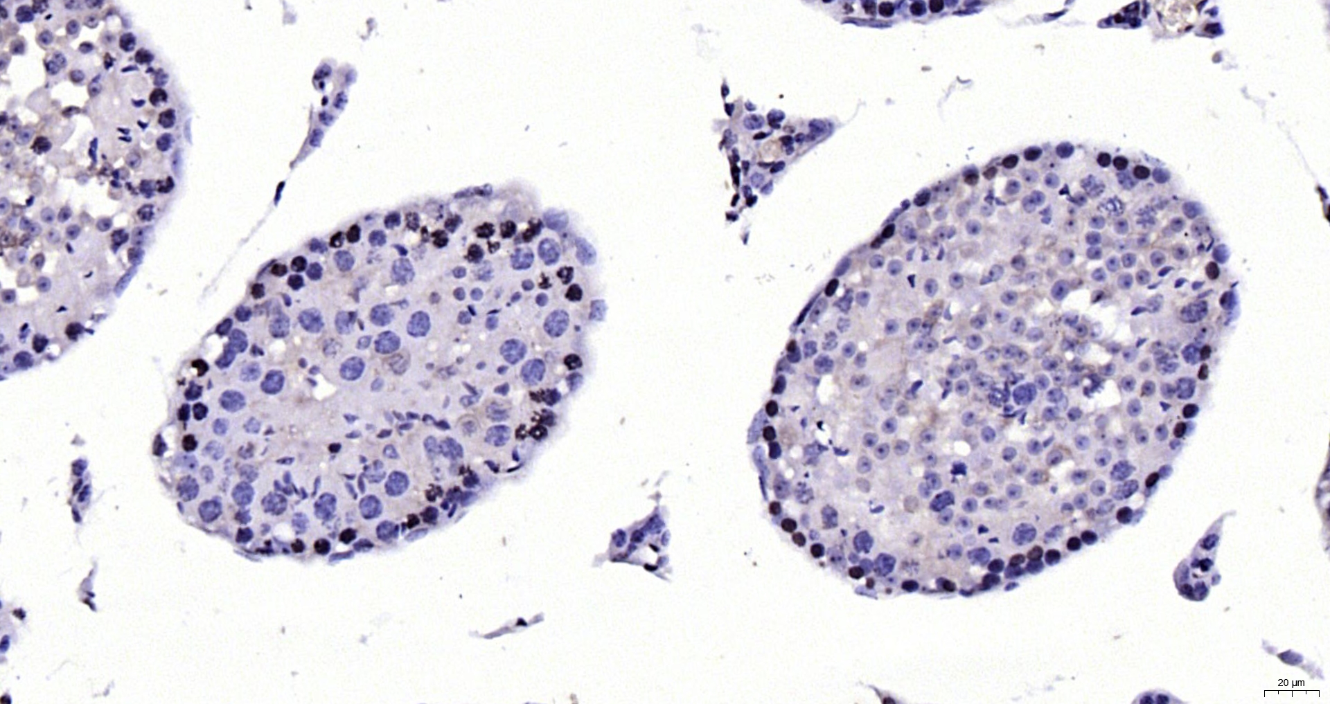 Paraformaldehyde-fixed, paraffin embedded Mouse testis; Antigen retrieval by boiling in sodium citrate buffer (pH6.0) for 15min; Block endogenous peroxidase by 3% hydrogen peroxide for 20 minutes; Blocking buffer (normal goat serum) at 37°C for 30min; Antibody incubation with CDKN1A Polyclonal Antibody, Unconjugated (bs-0741R) at 1:200 overnight at 4°C, DAB staining.