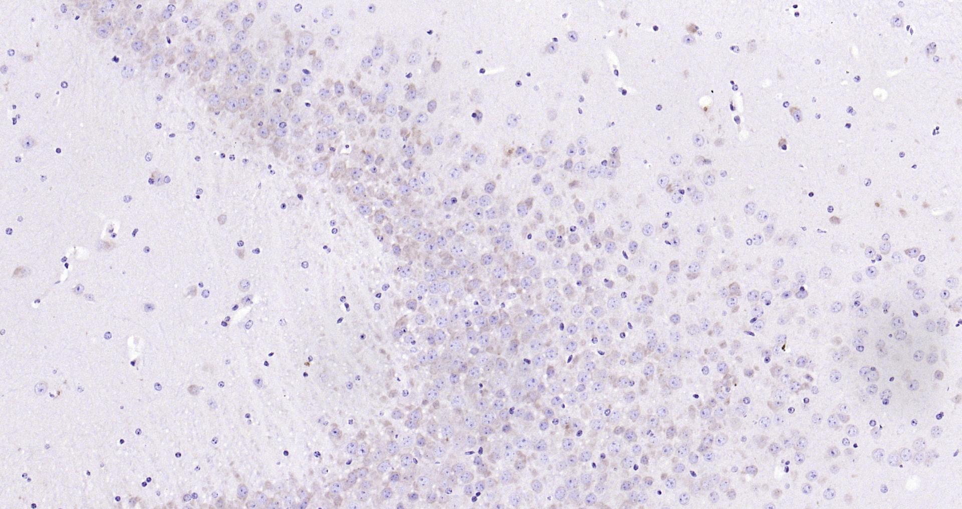Paraformaldehyde-fixed, paraffin embedded Mouse brain; Antigen retrieval by boiling in sodium citrate buffer (pH6.0) for 15min; Block endogenous peroxidase by 3% hydrogen peroxide for 20 minutes; Blocking buffer (normal goat serum) at 37°C for 30min; Antibody incubation with GANAB Polyclonal Antibody, Unconjugated (bs-6720R) at 1:200 overnight at 4°C, DAB staining. Paraformaldehyde-fixed, paraffin embedded Mouse brain; Antigen retrieval by boiling in sodium citrate buffer (pH6.0) for 15min; Block endogenous peroxidase by 3% hydrogen peroxide for 20 minutes; Blocking buffer (normal goat serum) at 37°C for 30min; Antibody incubation with GANAB Polyclonal Antibody, Unconjugated (bs-6720R) at 1:200 overnight at 4°C, DAB staining.