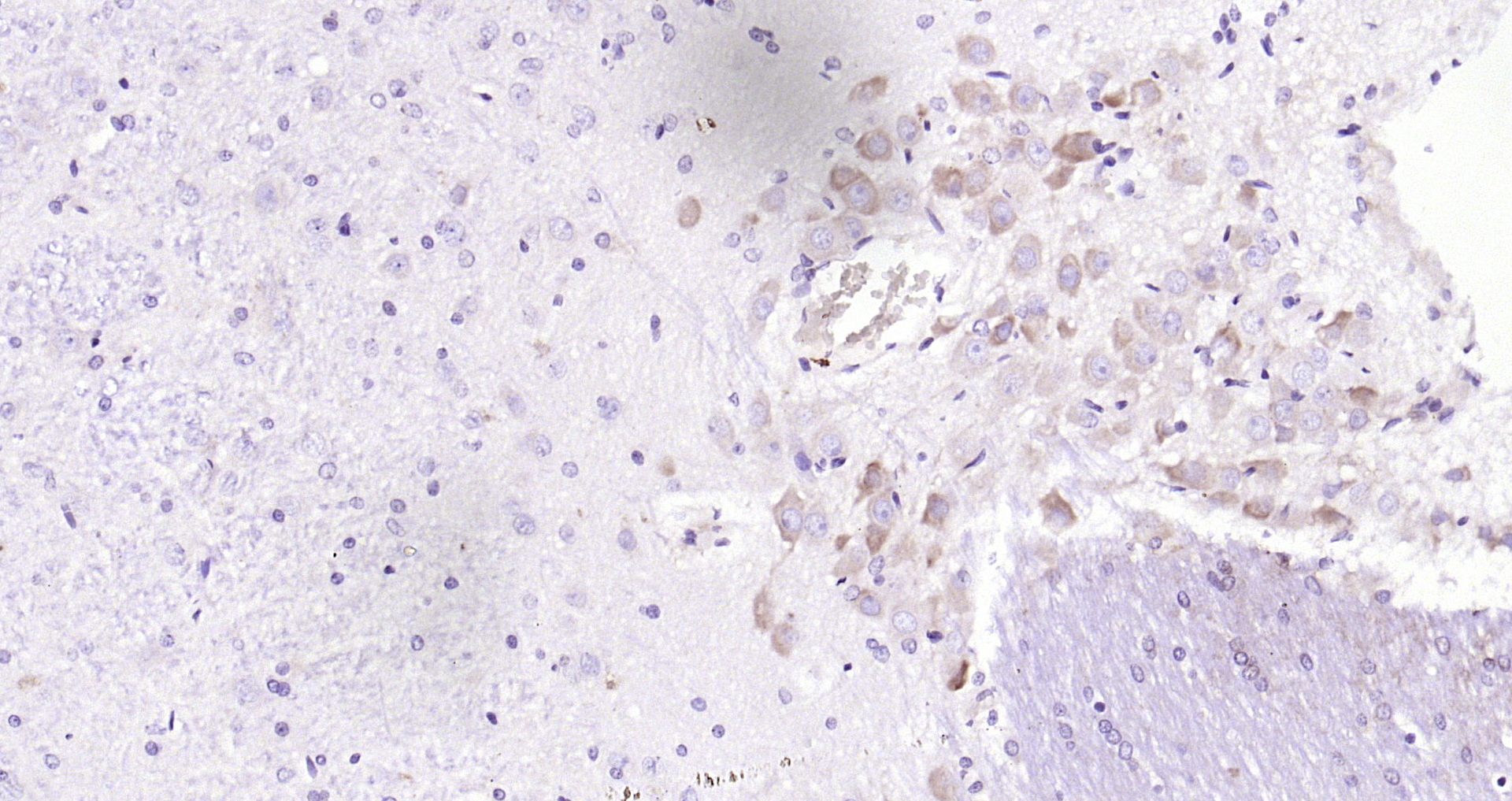 Paraformaldehyde-fixed, paraffin embedded Rat brain; Antigen retrieval by boiling in sodium citrate buffer (pH6.0) for 15min; Block endogenous peroxidase by 3% hydrogen peroxide for 20 minutes; Blocking buffer (normal goat serum) at 37°C for 30min; Antibody incubation with GANAB Polyclonal Antibody, Unconjugated (bs-6720R) at 1:200 overnight at 4°C, DAB staining. Paraformaldehyde-fixed, paraffin embedded Rat brain; Antigen retrieval by boiling in sodium citrate buffer (pH6.0) for 15min; Block endogenous peroxidase by 3% hydrogen peroxide for 20 minutes; Blocking buffer (normal goat serum) at 37°C for 30min; Antibody incubation with GANAB Polyclonal Antibody, Unconjugated (bs-6720R) at 1:200 overnight at 4°C, DAB staining.