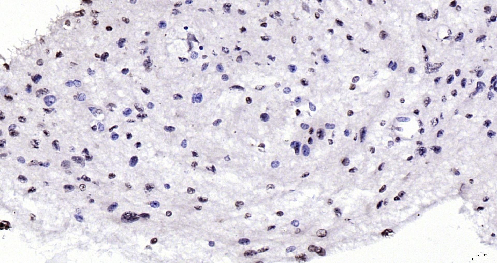 Paraformaldehyde-fixed, paraffin embedded Human brain; Antigen retrieval by boiling in sodium citrate buffer (pH6.0) for 15min; Block endogenous peroxidase by 3% hydrogen peroxide for 20 minutes; Blocking buffer (normal goat serum) at 37°C for 30min; Antibody incubation with eIF4G Polyclonal Antibody, Unconjugated (bs-3843R) at 1:200 overnight at 4°C, DAB staining.