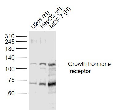 Lane 1: Human U2os cell lysates; Lane 2: Human HepG2 cell lysates; Lane 3: Human MCF-7 cell lysates probed with Growth hormone receptor Polyclonal Antibody, Unconjugated (bs-23024R) at 1:1000 dilution and 4˚C overnight incubation. Followed by conjugated secondary antibody incubation at 1:20000 for 60 min at 37˚C. Lane 1: Human U2os cell lysates; Lane 2: Human HepG2 cell lysates; Lane 3: Human MCF-7 cell lysates probed with Growth hormone receptor Polyclonal Antibody, Unconjugated (bs-23024R) at 1:1000 dilution and 4˚C overnight incubation. Followed by conjugated secondary antibody incubation at 1:20000 for 60 min at 37˚C.