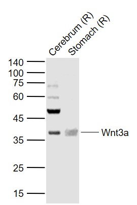Lane 1: Rat Cerebrum tissue lysates; Lane 2: Rat Stomach tissue lysates probed with Wnt3a Polyclonal Antibody, Unconjugated (bs-23278R) at 1:1000 dilution and 4˚C overnight incubation. Followed by conjugated secondary antibody incubation at 1:20000 for 60 min at 37˚C. Lane 1: Rat Cerebrum tissue lysates; Lane 2: Rat Stomach tissue lysates probed with Wnt3a Polyclonal Antibody, Unconjugated (bs-23278R) at 1:1000 dilution and 4˚C overnight incubation. Followed by conjugated secondary antibody incubation at 1:20000 for 60 min at 37˚C.