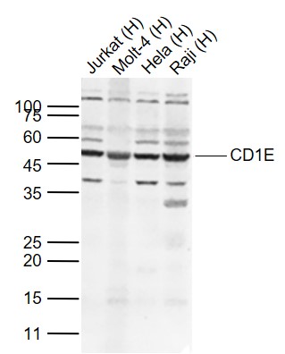 Lane 1: Human Jurkat cell lysates; Lane 2: Human Molt-4 cell lysates; Lane 3: Human Hela cell lysates; Lane 4: Human Raji cell lysates probed with CD1E Polyclonal Antibody, Unconjugated (bs-23497R) at 1:500 dilution and 4˚C overnight incubation. Followed by conjugated secondary antibody incubation at 1:20000 for 60 min at 37˚C.