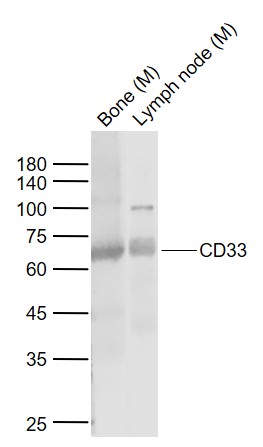 Lane 1: Mouse Bone tissue lysates; Lane 2: Mouse Lymph node tissue lysates probed with CD33 Polyclonal Antibody, Unconjugated (bs-23755R) at 1:1000 dilution and 4˚C overnight incubation. Followed by conjugated secondary antibody incubation at 1:20000 for 60 min at 37˚C.