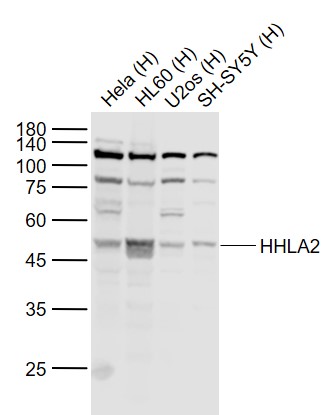 Lane 1: Human Hela cell lysates; Lane 2: Human HL60 cell lysates; Lane 3: Human U2os cell lysates; Lane 4: Human SH-SY5Y cell lysates probed with HHLA2 Polyclonal Antibody, Unconjugated (bs-23898R) at 1:1000 dilution and 4˚C overnight incubation. Followed by conjugated secondary antibody incubation at 1:20000 for 60 min at 37˚C.