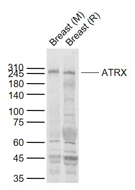 Lane 1: Mouse Breast tissue lysates; Lane 2: Rat Breast tissue lysates probed with ATRX Polyclonal Antibody, Unconjugated (bs-24302R) at 1:1000 dilution and 4˚C overnight incubation. Followed by conjugated secondary antibody incubation at 1:20000 for 60 min at 37˚C.