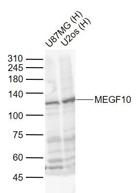 Lane 1: Human U87MG cell lysates; Lane 2: Human U2os cell lysates probed with MEGF10 Polyclonal Antibody, Unconjugated (bs-24335R) at 1:1000 dilution and 4˚C overnight incubation. Followed by conjugated secondary antibody incubation at 1:20000 for 60 min at 37˚C.
