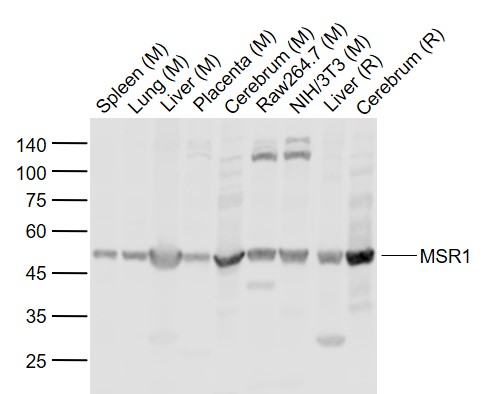 Lane 1: Mouse Spleen tissue lysates; Lane 2: Mouse Lung tissue lysates; Lane 3: Mouse Liver tissue lysates; Lane 4: Mouse Placenta tissue lysates ; Lane 5: Mouse Cerebrum tissue lysates; Lane 6: Mouse Raw264.7 cell lysates; Lane 7: Mouse NIH/3T3 cell lysates; Lane 8: Rat Liver tissue lysates; Lane 9: Rat Cerebrum tissue lysates probed with MSR1 Polyclonal Antibody, Unconjugated (bs-24362R) at 1:1000 dilution and 4˚C overnight incubation. Followed by conjugated secondary antibody incubation at 1:20000 for 60 min at 37˚C.