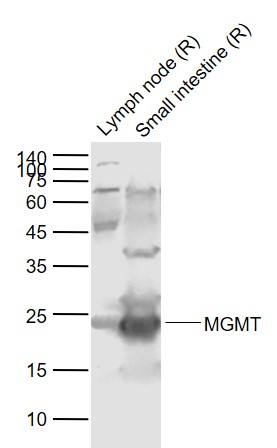 Lane 1: Rat Lymph node tissue lysates; Lane 2: Rat Small intestine tissue lysates probed with MGMT Polyclonal Antibody, Unconjugated (bs-24479R) at 1:1000 dilution and 4˚C overnight incubation. Followed by conjugated secondary antibody incubation at 1:20000 for 60 min at 37˚C.