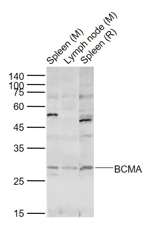 Lane 1: Mouse Spleen tissue lysates; Lane 2: Mouse Lymph node tissue lysates; Lane 3: Rat Spleen tissue lysates probed with BCMA Polyclonal Antibody, Unconjugated (bs-24539R) at 1:1000 dilution and 4˚C overnight incubation. Followed by conjugated secondary antibody incubation at 1:20000 for 60 min at 37˚C.