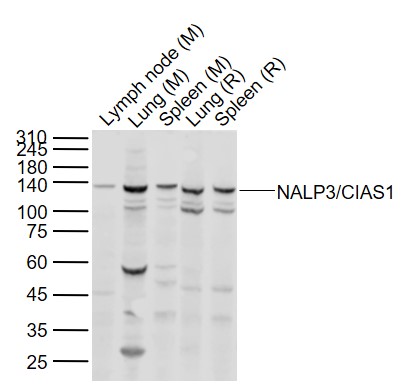 Lane 1: Mouse Lymph node tissue lysates; Lane 2: Mouse Lung tissue lysates; Lane 3: Mouse Spleen tissue lysates; Lane 4: Rat Lung tissue lysates ; Lane 5: Rat Spleen tissue lysates probed with NALP3/CIAS1 Polyclonal Antibody, Unconjugated (bs-24563R) at 1:1000 dilution and 4˚C overnight incubation. Followed by conjugated secondary antibody incubation at 1:20000 for 60 min at 37˚C.