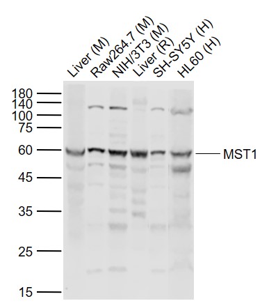 Lane 1: Mouse Liver tissue lysates; Lane 2: Mouse Raw264.7 cell lysates; Lane 3: Mouse NIH/3T3 cell lysates; Lane 4: Rat Liver tissue lysates ; Lane 5: Human SH-SY5Y cell lysates ; Lane 6: Human HL60 cell lysates probed with MST1 Polyclonal Antibody, Unconjugated (bs-28134R) at 1:1000 dilution and 4˚C overnight incubation. Followed by conjugated secondary antibody incubation at 1:20000 for 60 min at 37˚C.