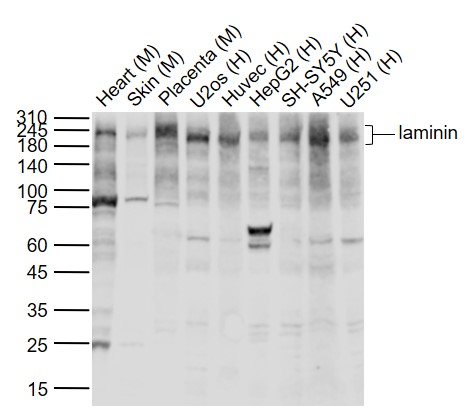 Lane 1: Human Heart tissue lysates; Lane 2: Mouse Skin tissue lysates; Lane 3: Mouse Placenta tissue lysates; Lane 4: Human U2os cell lysates ; Lane 5: Human Huvec cell lysates;Lane 6: Human HepG2 cell lysates; Lane 7: Human SH-SY5Y cell lysates; Lane 8: Human A549 cell lysates; Lane 9: Human U251 cell lysates probed with laminin Polyclonal Antibody, Unconjugated (bs-34067R) at 1:1000 dilution and 4˚C overnight incubation. Followed by conjugated secondary antibody incubation at 1:20000 for 60 min at 37˚C. Lane 1: Human Heart tissue lysates; Lane 2: Mouse Skin tissue lysates; Lane 3: Mouse Placenta tissue lysates; Lane 4: Human U2os cell lysates ; Lane 5: Human Huvec cell lysates;Lane 6: Human HepG2 cell lysates; Lane 7: Human SH-SY5Y cell lysates; Lane 8: Human A549 cell lysates; Lane 9: Human U251 cell lysates probed with laminin Polyclonal Antibody, Unconjugated (bs-34067R) at 1:1000 dilution and 4˚C overnight incubation. Followed by conjugated secondary antibody incubation at 1:20000 for 60 min at 37˚C.
