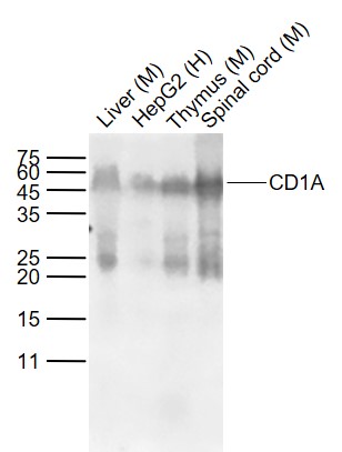 Lane 1: Mouse Liver tissue lysates; Lane 2: Human HepG2 cell lysates; Lane 3: Mouse Thymus tissue lysates; Lane 4: Mouse Spinal cord tissue lysates probed with CD1A Monoclonal Antibody, Unconjugated (bsm-33074M) at 1:1000 dilution and 4˚C overnight incubation. Followed by conjugated secondary antibody incubation at 1:20000 for 60 min at 37˚C.