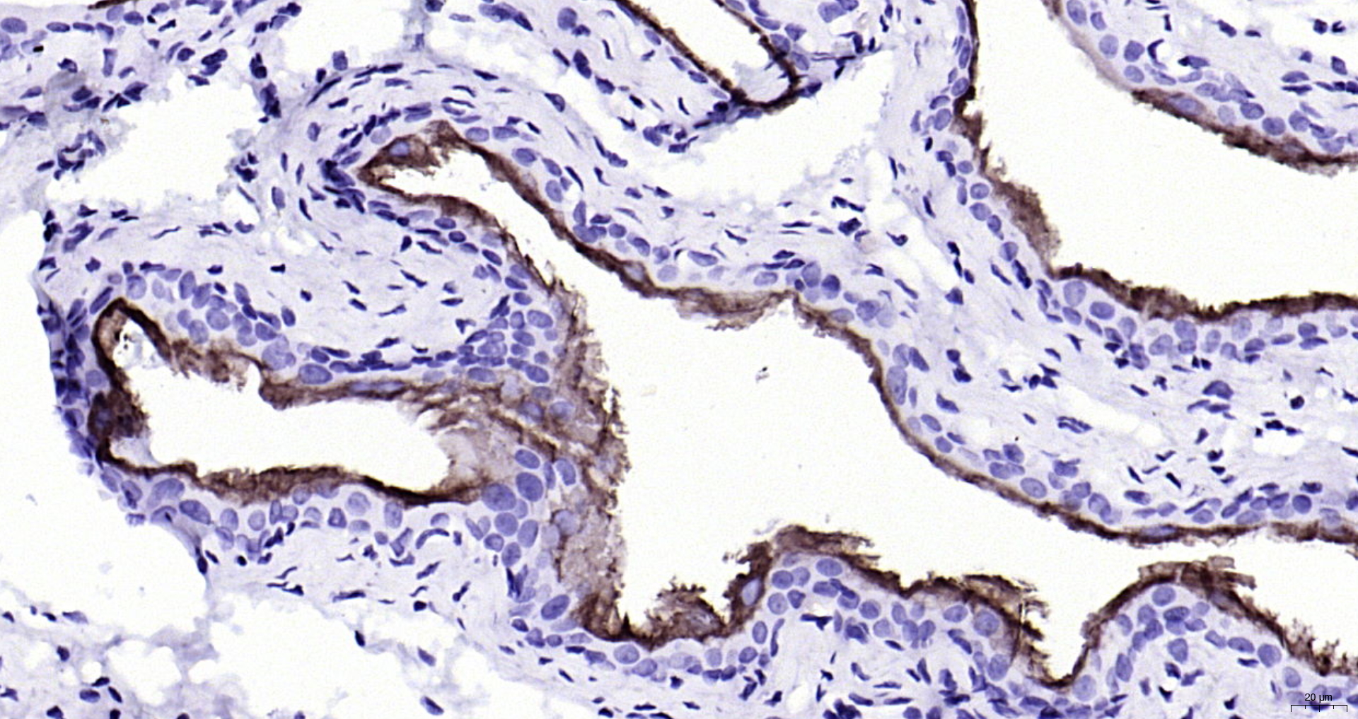 Paraformaldehyde-fixed, paraffin embedded Rat bladder; Antigen retrieval by boiling in sodium citrate buffer (pH6.0) for 15min; Block endogenous peroxidase by 3% hydrogen peroxide for 20 minutes; Blocking buffer (normal goat serum) at 37°C for 30min; Antibody incubation with Cytokeratin 20 (1F10) Monoclonal Antibody, Unconjugated (bsm-52060R) at 1:200 overnight at 4°C, DAB staining.